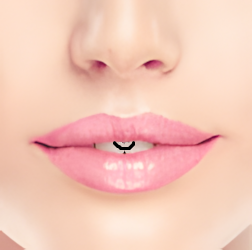 Lippenbändchen
