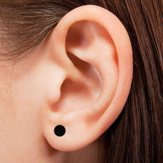 Lobe