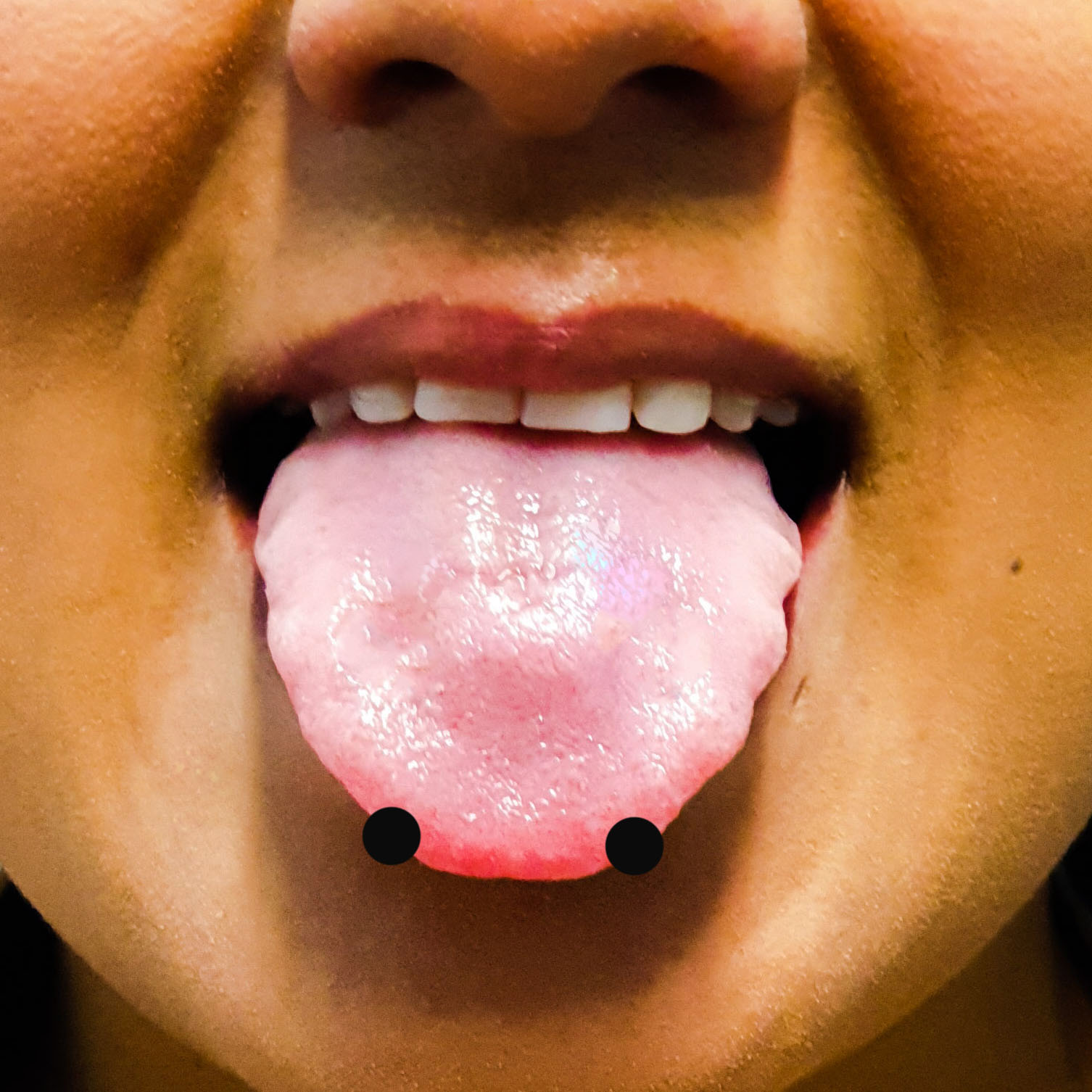 Snake Eyes